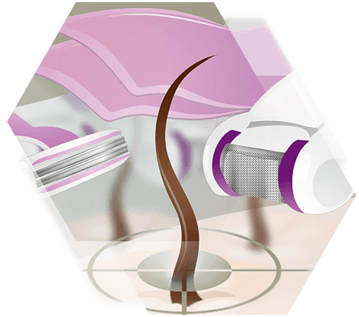 Illustration other Methods hair removal